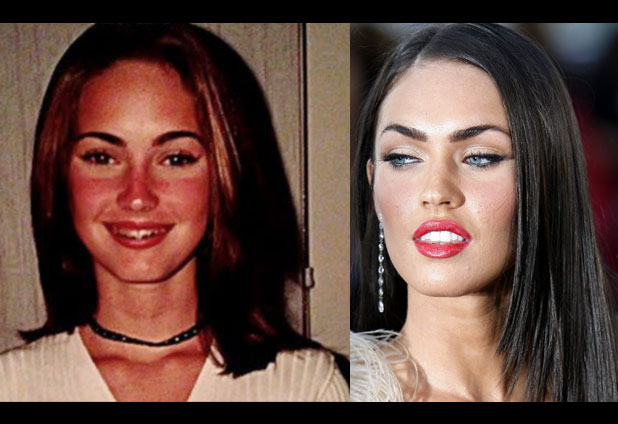 El Antes Y Despues De Los Famosos Emol Fotos 